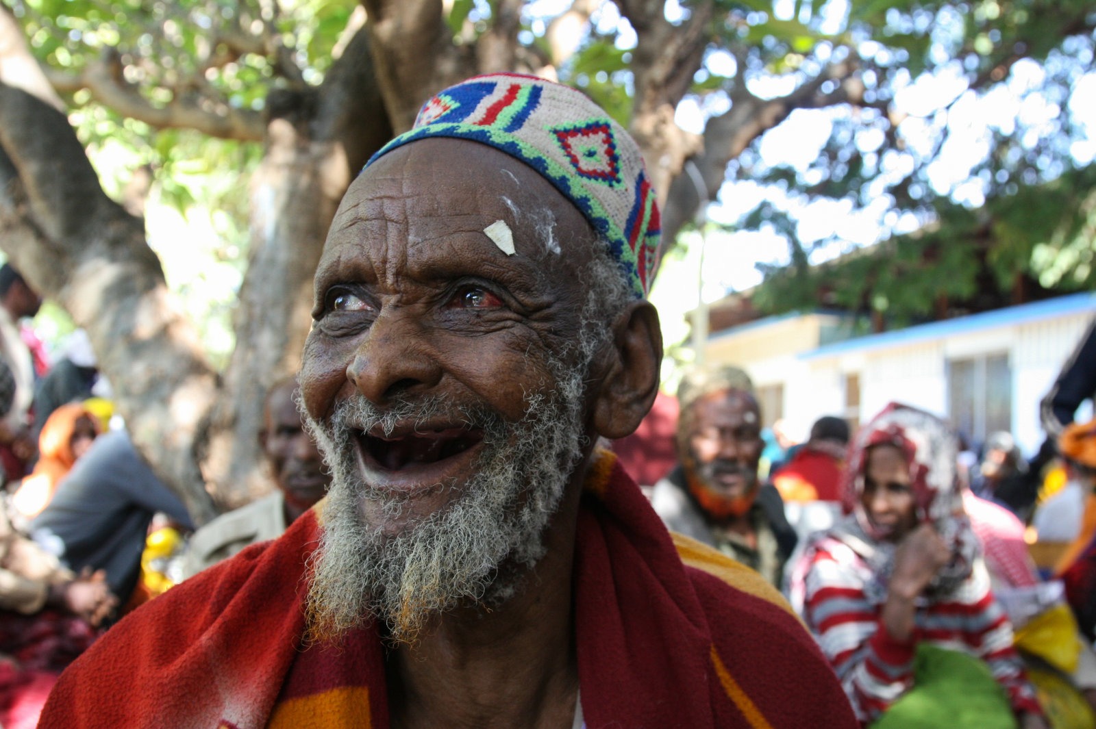 Cataracts ethiopia tues weds 179 51