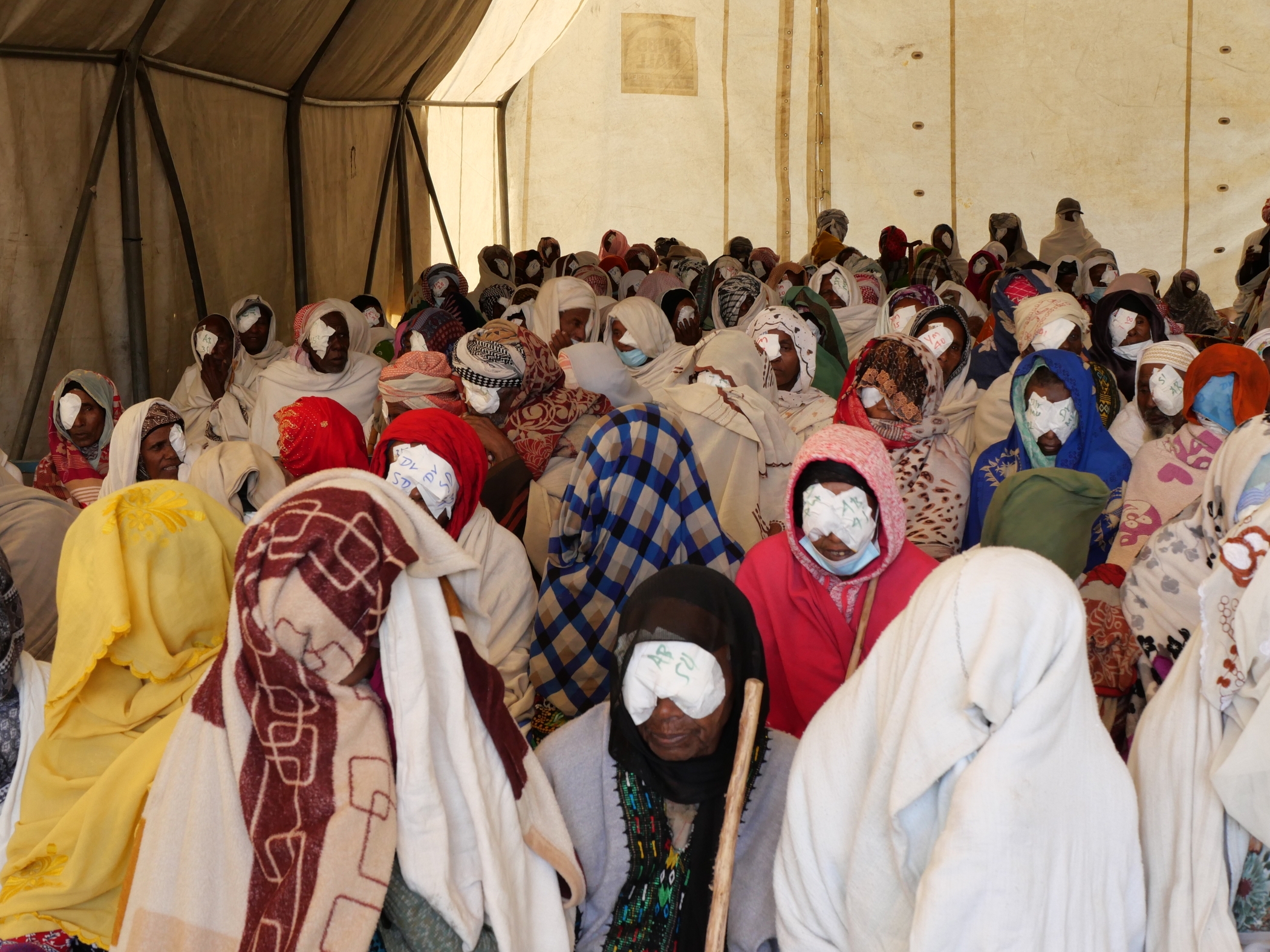 Patients at an outreach in Ethiopia wait for bandage removal.