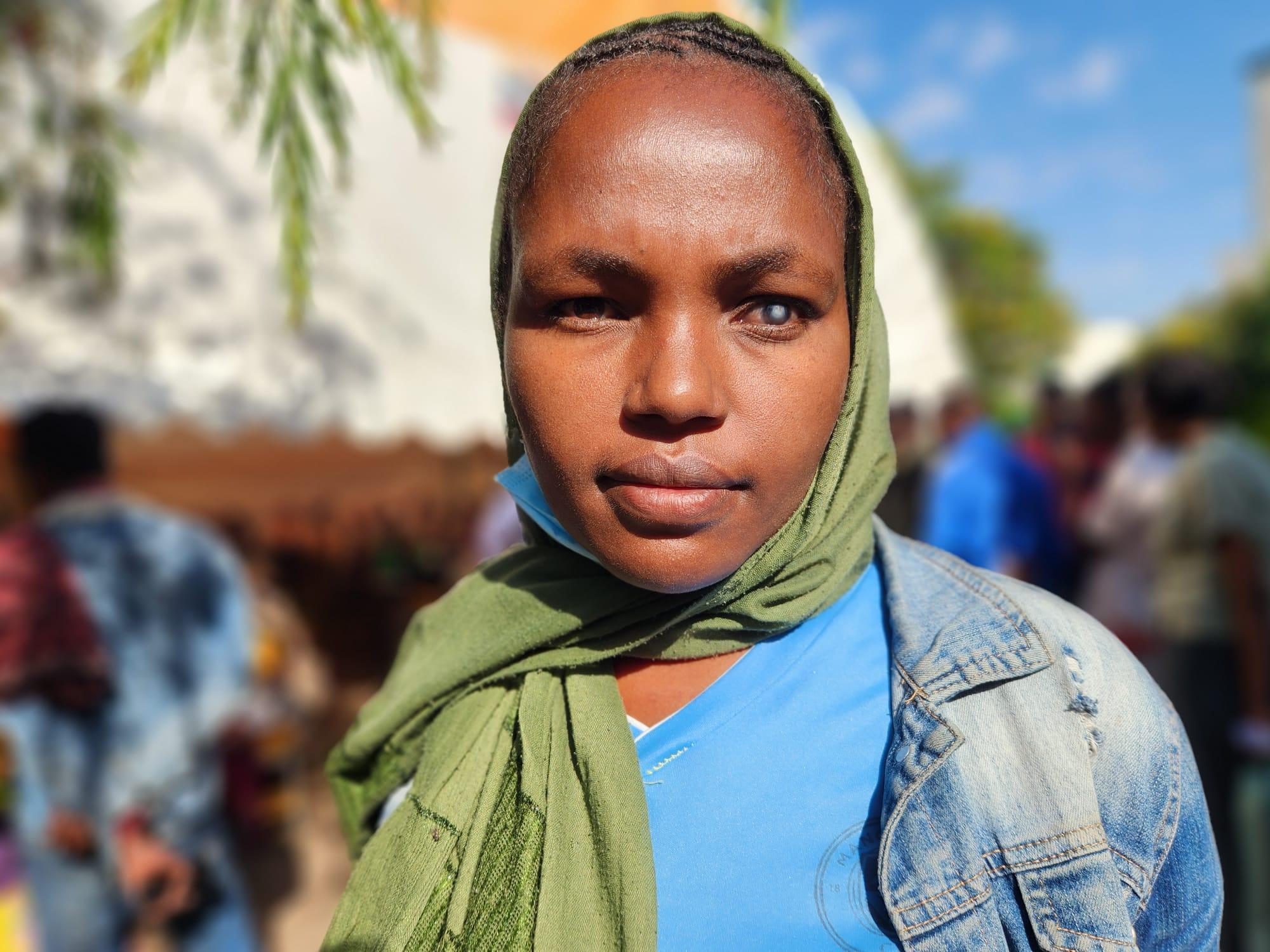 Women in Ethiopia with a cataract in one eye
