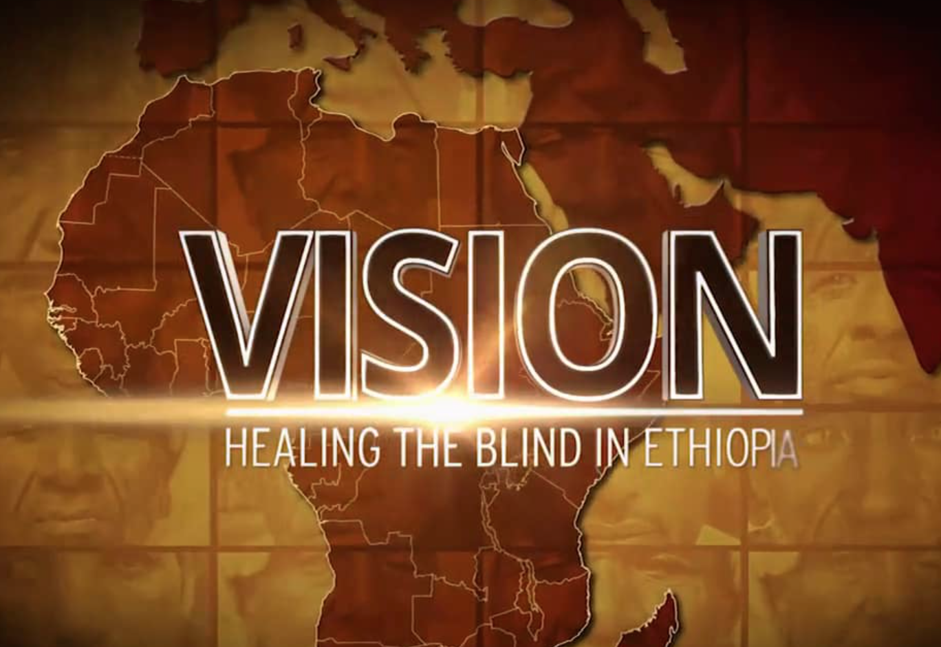 Vision